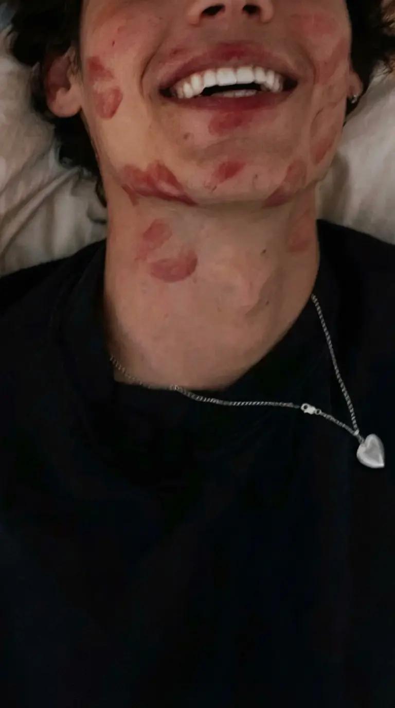 Liam thumbnail