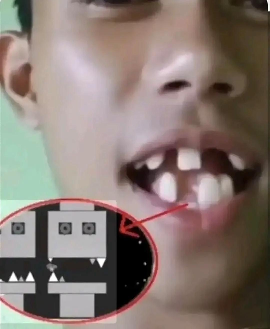 Chomper thumbnail