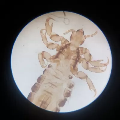 Parellel