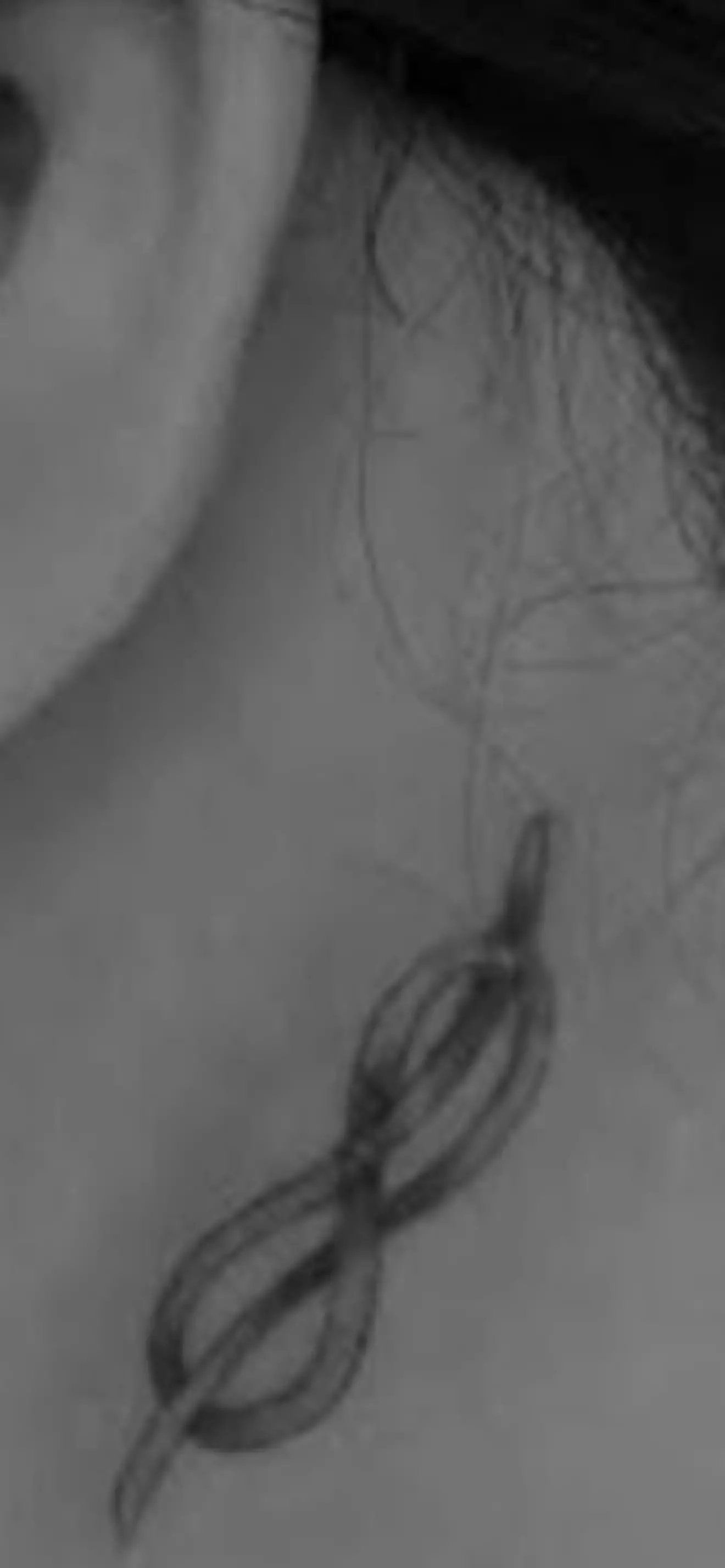 Rayane 