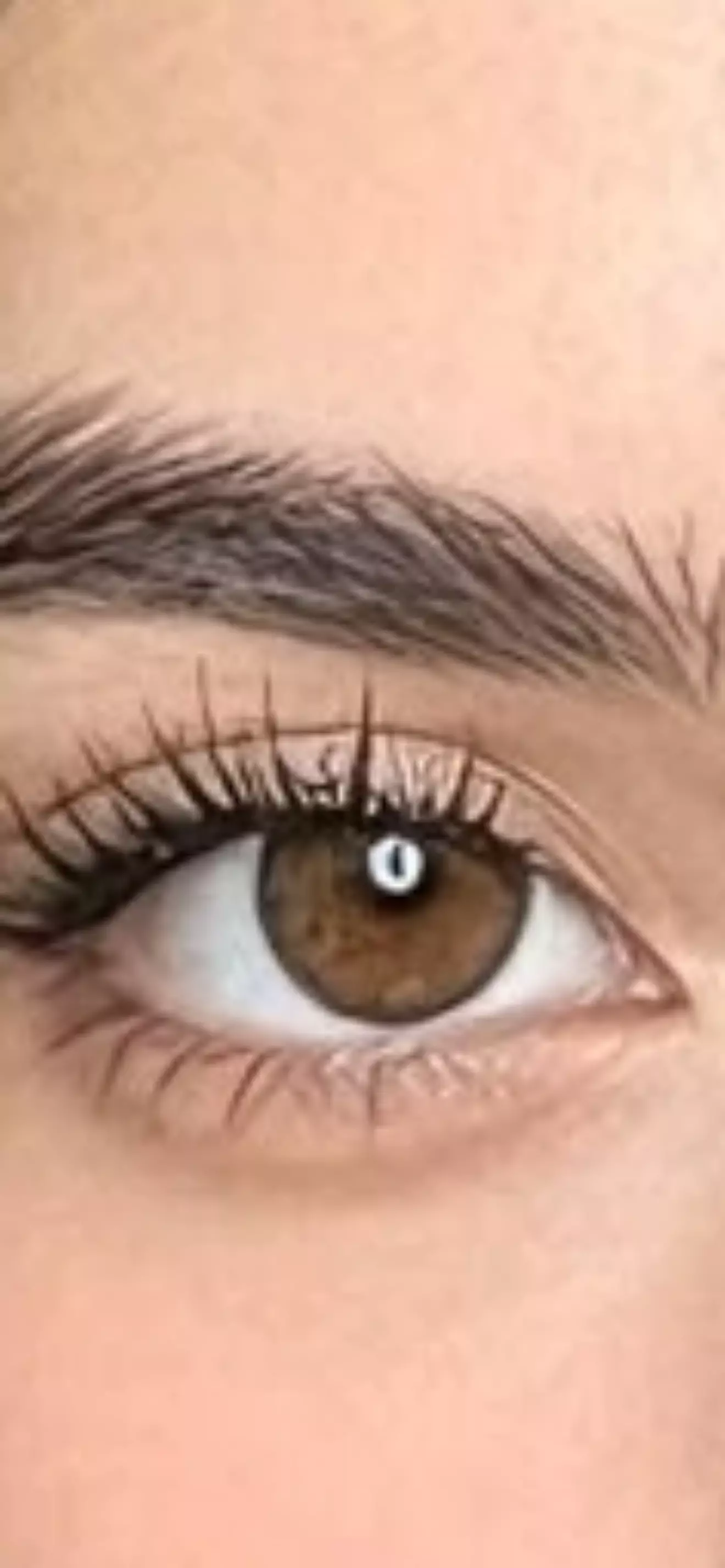 Radella