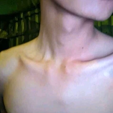 Phat