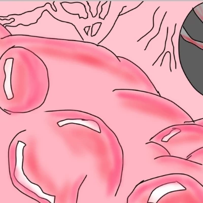 Random squishy place  thumbnail