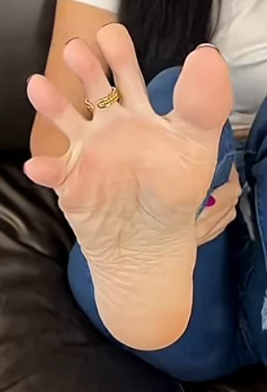 toe ring removal feet thumbnail