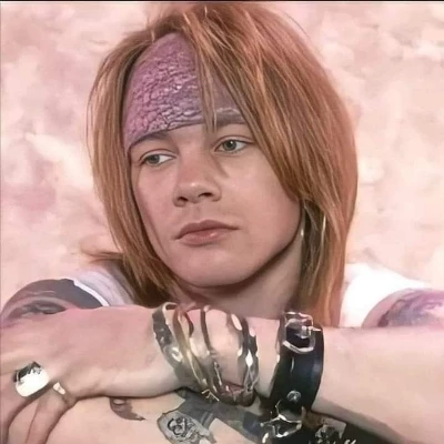 Axl Rose thumbnail