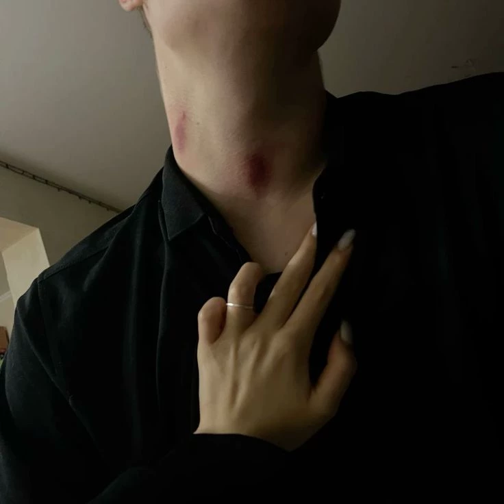 Zayden (enemigo) thumbnail