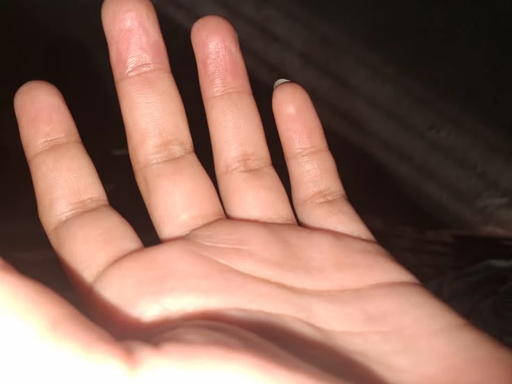hand thumbnail