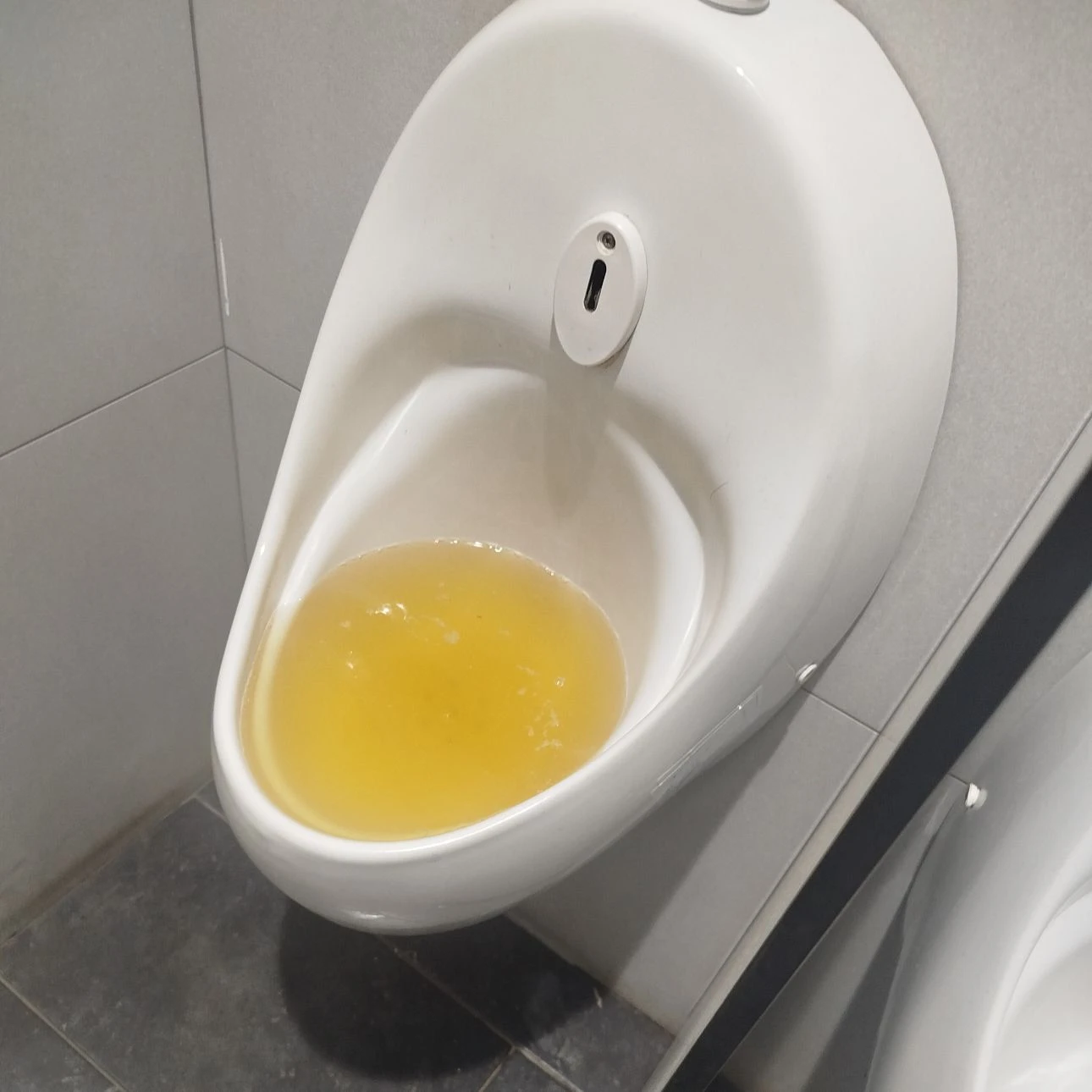 Your pee thumbnail