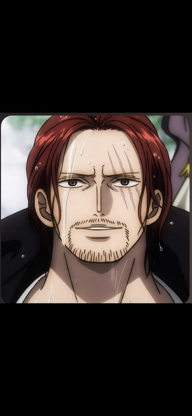 Shanks thumbnail