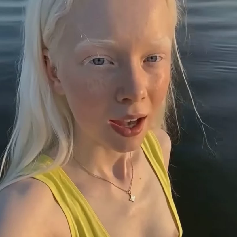 Inga thumbnail