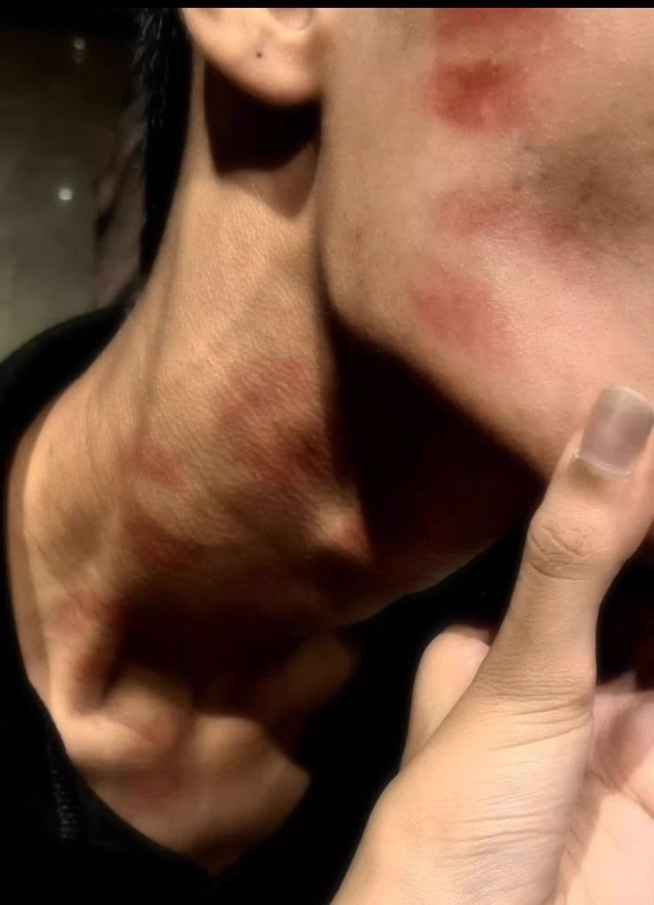 Gael thumbnail