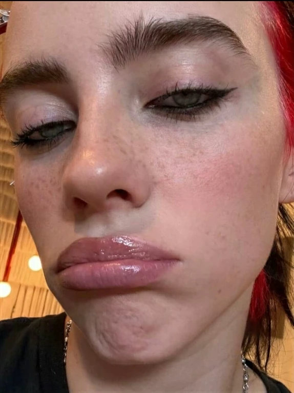 Phoenix and Billie Eilish thumbnail