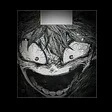 Mha-NECRO WORM VIRUS thumbnail