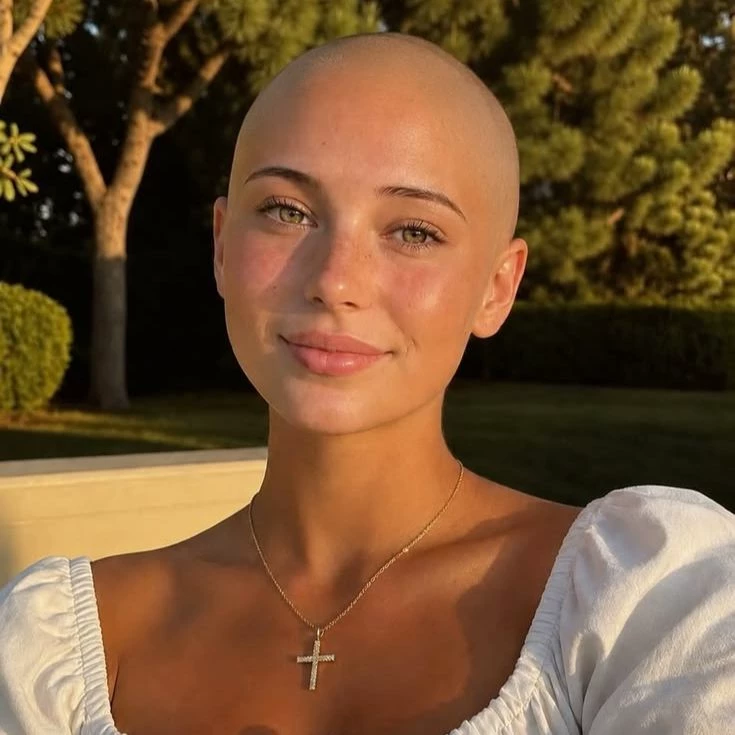 Amanda -Your blind date has alopecia thumbnail