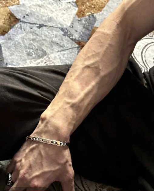 Damon thumbnail