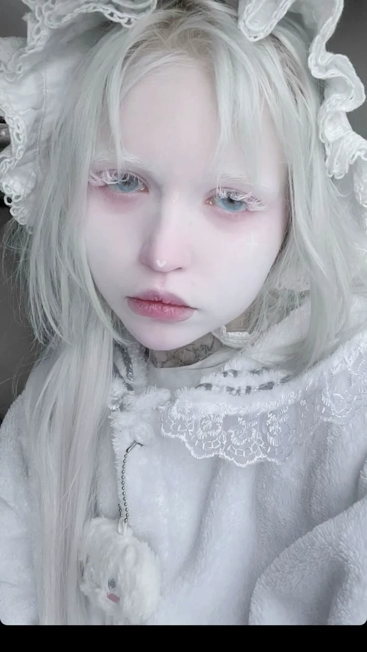 Albinism. thumbnail