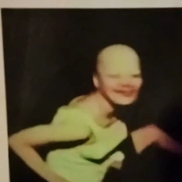 bald cockroach thumbnail