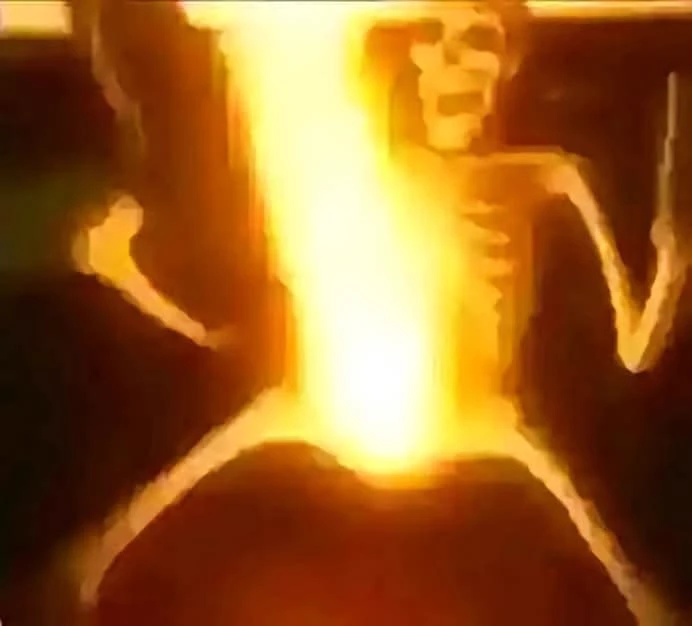 Skeleton  thumbnail