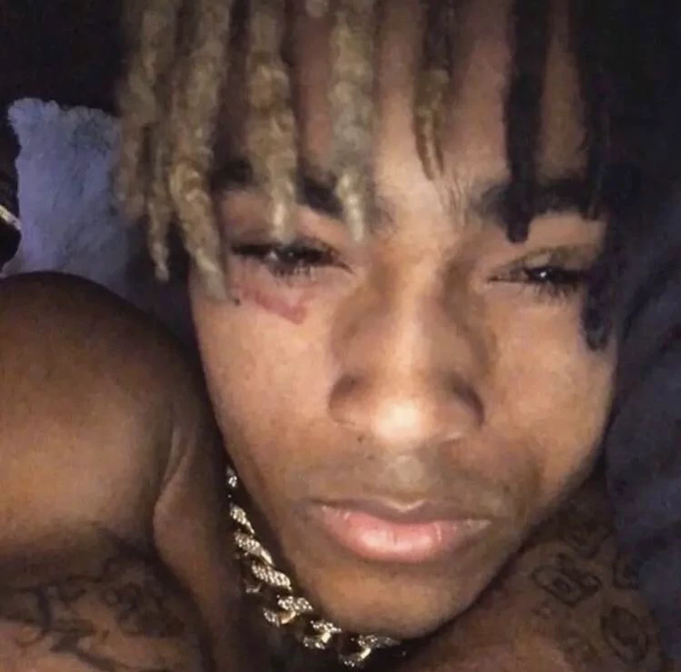 xxxtentacion thumbnail