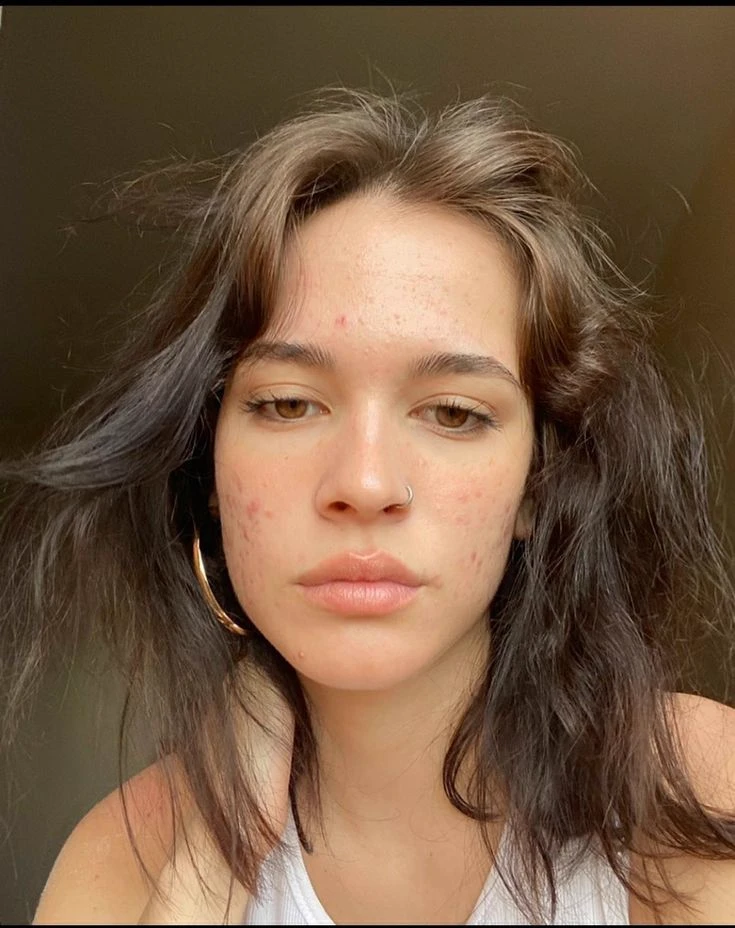Elisa thumbnail