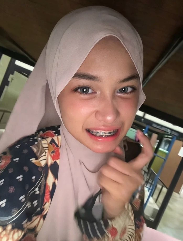 Anis thumbnail