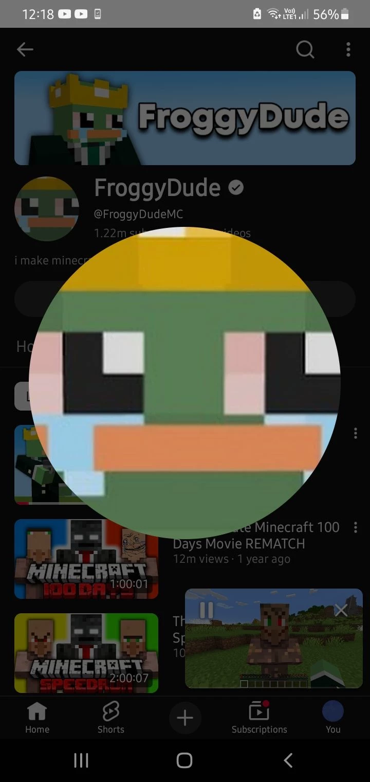 Froggydude (rabies) thumbnail